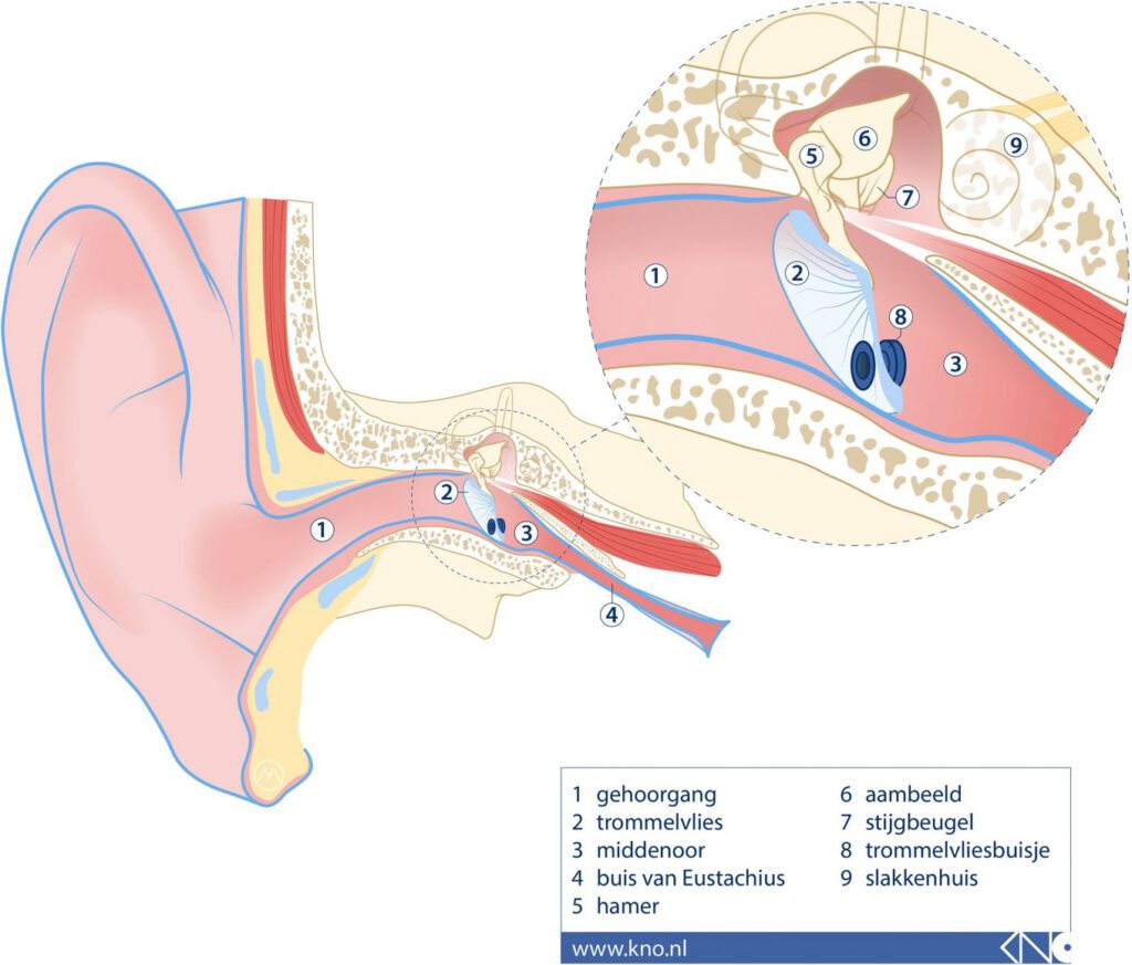 trommelvliesbuisje op Doof.nl